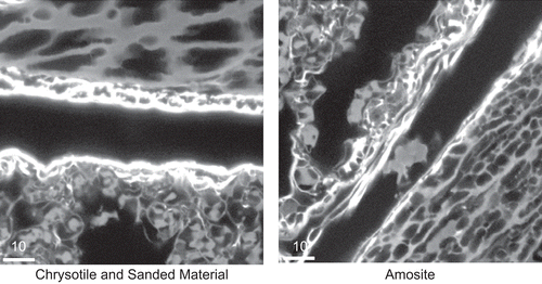 Figure 21.  Representative images of the pleural space at 181 days after cessation of exposure for the chrysotile fibers and sanded joint compound particles group and the amosite group. No inflammatory cells were observed in the pleural space of the CSP exposed animal. The right-hand image is from an amosite-exposed animal and shows a mass of inflammatory cells within the pleural space. The micron bar in the lower left corner is 10 µm in length.