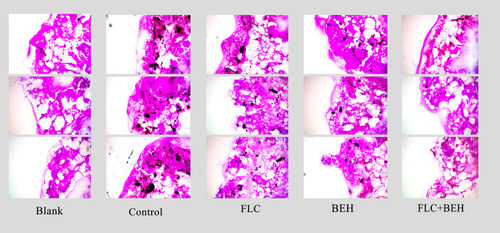 Figure 2 Histopathology of Galleria mellonella infected with Candida albicans. The concentration of yeast cells was 5×108 CFU/larva. Treatments consisted of phosphate buffered saline (PBS), fluconazole (FLC) (160 μg/mL), benserazide hydrochloride (BEH) (96 μg/mL), and a combination of FLC and BEH. Melanized nodules were the mixtures of yeast cells and filaments. The photographs were from three independent experiments.