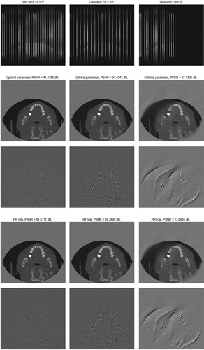 Figure 7. The projection data of teeth (the first row): full-angle sinogram with different angular step size Δθ=5∘, 10∘ (total view angle is 180∘) and limited angle sinogram (total opening angle is 100∘. The reconstructed image and error map of SBI (Algorithm 2) with different parameter choice rules: manual parameter selection (the second row and the third row), HR rule (the fourth row and the fifth row).