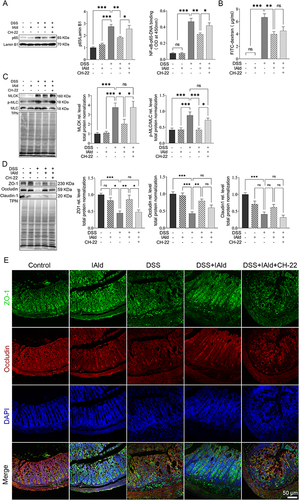 Figure 2 Effects of IAld supplementation on gut barrier integrity in a DSS-induced mouse model.