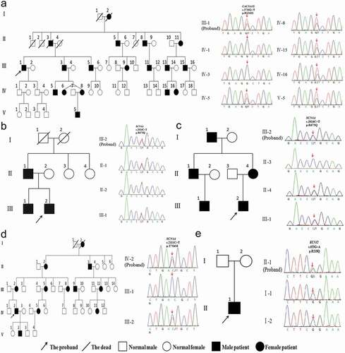 Figure 1. Pedigree and genetic analysis of five patients with primary periodic paralysis. (a) Patient 1, CACNA1S c.3726 G > T (p.R1242S) mutation. (b) Patient 2, SCN4A c.2024 C > T (p.R675Q) mutation. (c) Patient 3, SCN4A c.2024 G > A (p.R675Q) mutation. (d) Patient 4, SCN4A c.2111 C > T (p.T704M) mutation. (e) Patient 5, KCNJ2 c.653 G > A (p.R218Q) mutation
