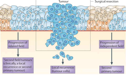 Figure 2. Field cancerization and local relapse.