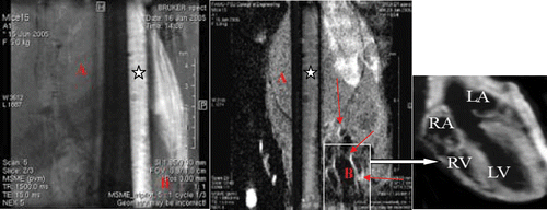 Figure 7. (On left panel) The figure represents MRI images of a capillary filled with iron oxide--myoglobin at pH 7.4 in presence of phosphate buffered saline pH7.4. In the background, mice body cross-sectional single slice image is shown with heart image (at the botton on right) without contrast agent. (On right panel) Same capillary with myoglobin at pH 4.0 in presence of acetate buffer pH 4.0 shows loss of signal of iron--oxide--myoglobin shown with asterisk. The images were generated using multislice multiecho spin echo proton density weighted technique at scan parameters TE = 15 ms, TR = 1500 ms, matrix 256 × 256, NEX = 2, FOV = 2.5 cm at 11.7 T or 500 MHz MRI imager. In the background, a same cross-sectional slice image of mice image after anti-myoglobin-iron oxide superparamagnetic contrast injection with cardiac territories are shown by arrows and details of different heart chambers (marked as RA, LA, LV, RV) can be seen in insert. Notice the enhancement of vascular wall regions rich with anti-myoglobin bound superparamagnetic particles after injection at pH 7.4 while the same imaging contrast agent in the capillary turned darker at pH 4.0.