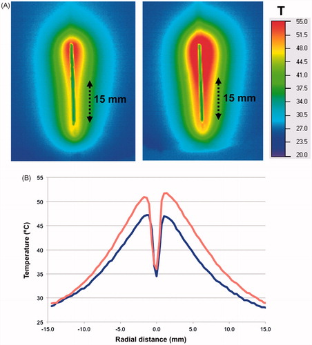 Figure 4. Hyperthermia probe temperature maps measured in vitro in gel phantoms. (A) Temperature maps after 3 min heating are plotted at 45 (left) and 50 °C (right) [probe tip at bottom; in animal studies, only the distal 15 mm was inserted into tissue (arrows)]. (B) Radial temperature profile ∼7 mm from the probe tip for 45 and 50 °C. Temperatures exceeding 41 °C (i.e. where doxorubicin release from TSL is expected) extend ∼4 and ∼6 mm from the probe for 45 and 50 °C, respectively. In vivo, these distances are likely somewhat reduced since blood perfusion-mediated cooling limits temperature spread into tissue.