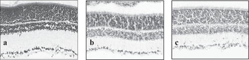 Figure 2 Nissl staining of (a) normal retina, (b) retina 2 days after injection with S100B and (c) retina 2 days after injection with IL-1β. Note that the tissue architecture is not affected by the injection and that the GCL layer appears intact without loss of the large ganglion cells.