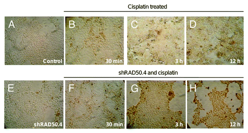 Figure 5. RAD50 suppression enhances cisplatin-induced DNA damage. TUNEL assays in (A) non-treated control MCF-7 cells, (B–D) treated with cisplatin alone, (E) transfected with shRAD50.4, and (F–H) treated with shRAD50.4 and cisplatin. Cells were analyzed 30 min (B and F), 3 h (C and G), and 12 h (D and H) after cisplatin treatments. Cells with nuclear staining were taken as positive in TUNEL reaction. Magnification is 60×.