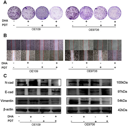 Figure 4. Overexpression of PKM2 alleviates the effect of combined treated on cell proliferation and migration. (A) Colony formation on OE-PKM2-Eca109 and OE-PKM2-Ec9706 for cell proliferation via PKM2. (B) Wound healing assay on OE-PKM2-Eca109 and OE-PKM2-Ec9706 for cell migration via PKM2. (C) The protein expression of N-cadherin, E-cadherin, Vimentin was determined by western-bloting analysis for cell migration and invasion via PKM2.