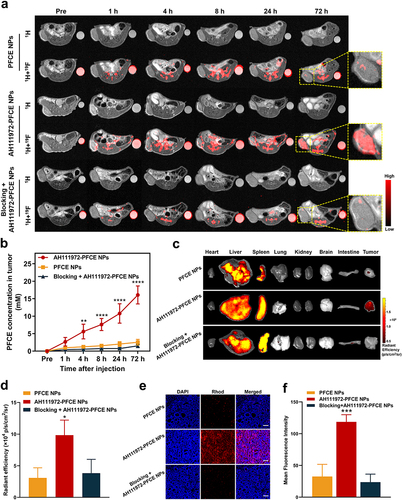 Figure 4 Validation of c-Met specificity of AH111972-PFCE NPs in vivo. (a) 1H MR and colocalized 19F MR images of the subcutaneous tumor murine model in AH111972-PFCE NPs, PFCE NPs and blocking groups (n = 3/group). For each mouse, 300 µL of AH111972-PFCE NPs or PFCE NPs were injected intravenously via the tail vein. A solution of AH111972-PFCE in an EP tube was used as an internal reference. (b) Quantitative analysis of PFCE concentration in the subcutaneous tumor before and after injection. (c) Ex vivo near infrared fluorescence (NIRF) images of tumor and major organs derived from mice in each group. (d) Quantifications of rhodamine-emitted signal in tumors expressed as radiant efficiency. (e) Confocal laser scanning microscopy images of SW948 dissected tumor tissue in each group after the last MRI; Scale bar is 100 µm. (f) Quantitative analysis of mean fluorescence intensity in SW948 dissected tumor tissue in each group after the last MRI. Data were expressed as mean ± SD, *P < 0.05, **P < 0.01, ***P < 0.001, ****P < 0.0001.