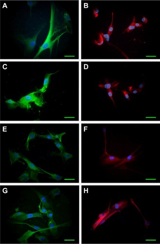 Figure 1 Expression of GFAP (green) and Nestin (red) in cultivated cells derived from tumor specimens.