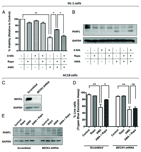 Figure 7. Inhibition of autophagy attenuates rapamycin-mediated protection against AMA toxicity in HL-1 and AC16 cardiomyocytes. (A) HL-1 cells were pre-treated with vehicle control or 1 µM rapamycin in the absence or presence of 5 mM 3-MA for 16 h, followed by treatment with 50 µM AMA for an additional 32 h, in the presence of rapamycin and 5mM 3-MA. Cell viability was subsequently assessed using MTT assay. *p < 0.05; **p < 0.01. Data represent three independent experiments. (B) HL-1 cells were treated as in (B), cell lysates collected and immunoblotted for PARP1. GAPDH is used as a loading control. (C) AC16 cells were transduced with a lentiviral vector expressing scrambled or BECN1 shRNA. Cells were subsequently lysed and immunoblotted for BECN1 protein expression. GAPDH is used as a loading control. (D) Scrambled or BECN1 shRNA-expressing cells were treated with AMA alone or were coincubated with rapamycin for 48 h. Cell viability was subsequently assessed using trypan blue exclusion assay. *p < 0.05; **p < 0.01.Data represent three independent experiments. (E) AC16 cells were treated as in (D), cell lysates collected and immunoblotted for PARP1. GAPDH is used as a loading control.