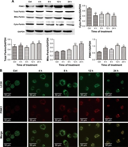 Figure 5 ZnO NPs activated PINK1/Parkin-mediated mitophagy in CAL 27 cells.Notes: After transfection with the GFP-LC3 plasmid, the cells were treated with or without 25 μg/mL ZnO NPs for 4, 8, 12, or 24 h. (A) The cells were then harvested and lysed, and the levels of the total Parkin, mito-Parkin, and cyto-Parkin proteins were evaluated by Western blotting. (B) Cells were harvested and then stained with IF-IC using the PINK1 antibody, and the expression of PINK1 and LC3 was determined using CLSM. #P>0.05; *P<0.05; **P<0.01; ***P<0.001.Abbreviations: Ctrl, control; CLSM, confocal laser scanning microscopy; ZnO NPs, zinc oxide nanoparticles.