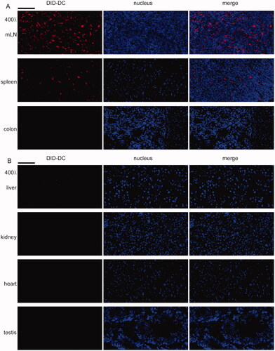 Figure 8. DCTP tracking in colitis mice. DCTP cells were labeled with DID and tracked by frozen sections, DAPI staining and fluorescence microscope observation. (A) DCTP was found in mLN and spleen but not colon. (B) No obvious DCTP was found in liver, kidney, heart, and testis (the scale bar represents 100 µm). Experiments were repeated three times.