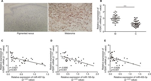 Figure 2 The relative expression of hTERT and miR-497-5p, miR-195-5p and miR-455-3p.Notes: (A) hTERT protein expression in melanoma and pigmented nevus tissues (magnification, ×100). (B) hTERT mRNA expression in melanoma and pigmented nevus tissues. hTERT mRNA expression level was inversely correlated with miR-497-5p (C), miR-195-5p (D) and miR-455-3p (E).Note: ***p<0.001, compared to control groups.Abbreviations: hTERT, human telomerase reverse transcriptase; M, melanoma group; C, control (pigmented nevi group).