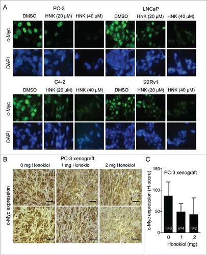 Figure 2. HNK treatment inhibits nuclear levels of c-Myc protein in prostate cancer cells. (A) Representative images for c-Myc protein levels in PC-3, LNCaP, C4-2, and 22Rv1 human prostate cancer cells after 24 hour treatment with DMSO or the indicated doses of HNK. (B) Representative images for c-Myc protein expression in tumor sections from PC-3 xenografts. Magnification, 400 ×; Scale bars = 100 µm. (C) Quantitation of c-Myc protein expression in PC-3 xenograft. Results shown are mean ± SD.