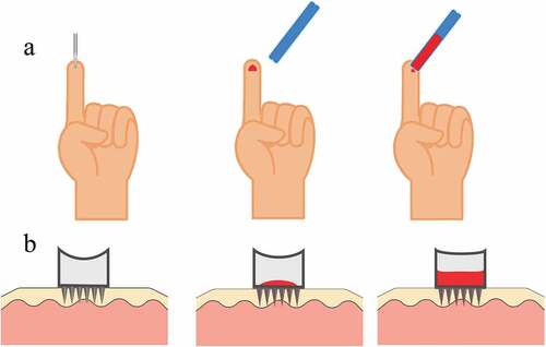 Figure 5. a – Passive collection of blood using a glass capillary tube. b – Active collection of blood through a hollow microneedle by application of suction.