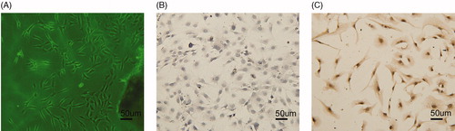 Figure 1. Identification of AFs: (A) AFs cells (100×); (B) negative expression of SMA by immunocytochemistry (100×); and (C) positive expression of vimentin by immunocytochemistry (100×).