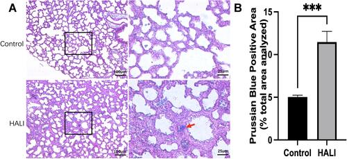 Figure 2 (A) Prussian blue staining in alveolar tissue. The columns on the right show magnified images of the black boxes in the left column. Scale bars = 25 μm, 100 μm. (B) Prussian Blue Positive Area (% total area analyzed). Iron deposition in lung tissue was significantly higher in the HALI group than in the control group (***P < 0.001). The values are the mean ± SD; n = 6 nonoverlapping fields/group.