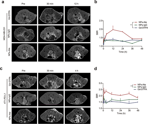 Figure 4 In vivo NPs-Ate MRI imaging. Images showing MDA-MB-231 (a and c), 4T1-PD-L1 (b and d) tumor-bearing mice signal to background ratio (SBR) at different times (c and d). NPs-IgG and Gd-DTPA with a 23.5 mg Gd3+/kg dose. Data are represented as the mean ± standard deviation (n=3), ** P<0.01.