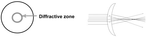 Figure 5 Diffractive SCL. There is a refractive part at the center, which is surrounded by many circular diffractive zones. A distant image is formed by refraction at the center, while a near image is formed in the diffractive zone on the inner surface of the lens.