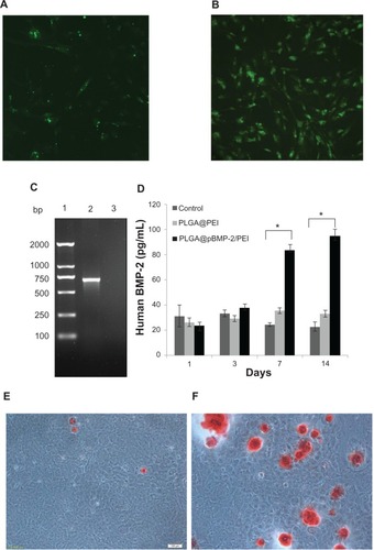 Figure 3 Evaluate properties of PLGA@pBMP-2/PEI in vitro. (A) Transfection ability of PLGA@pBMP-2/PEI/FITC in MC3T3-E1 cells at day 3; (B) Transfection ability of PLGA@ pBMP-2/PEI/FITC in MC3T3 cells at day 7; (C) PCR assays to confirm pBMP-2 in MC3T3 cells. Lane 1: DNA marker; Lane 2: PCR amplicon from PLGA@pBMP-2/PEI transfected MC3T3 cells; Lane 3: PCR from MC3T3 cells; (D) Human BMP-2 ELISA assays to confirm human BMP-2 secretion from transfected MC3T3 cells. (E) Calcium deposition analysis of PLGA@PEI group on day 14 using Alizarin red staining; (F) Calcium deposition analysis of PLGA@pBMP-2/PEI group on day 14 using Alizarin red staining.Note: *significant difference (p<0.01).Abbreviations: PLGA@PEI, poly(lactic-co-glycolic acid)@polyethlenimine; PLGA@pBMP-2/PEI, poly(lactic-co-glycolic acid)@plasmid of bone morphogenetic protein 2/polyethlenimine; PLGA@pBMP-2/PEI/FITC, poly(lactic-co-glycolic acid)@plasmid of bone morphogenetic protein 2/polyethlenimine/fluorescein isothiocyanate; bp, base pair; PCR, polymerase chain reaction; ELISA, enzyme-linked immunosorbent assay.