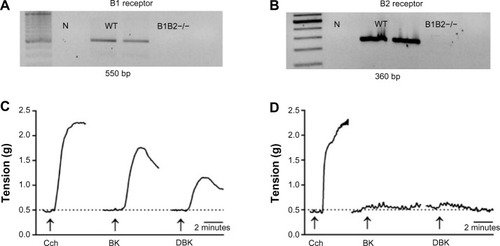 Figure 1 Genotyping the kinin B1 and B2 receptor in B1B2KO mice.