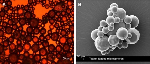 Figure 2 Microscopic analysis of totarol-loaded microspheres.
