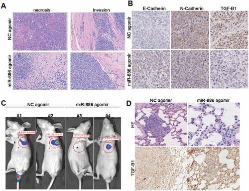 Figure 5. In vivo effect of miR-886-3P mimic on xenograft tumor formation, growth, and invasion.