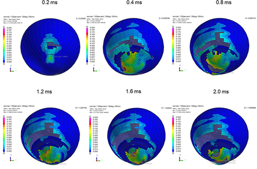 Figure 5 Sequential strain strength response of ocular surface of model eye upon airbag impact in 30°-gaze down position at 60 m/s with adhesion strength of scleral flap of 100%, shown at 0.4-ms intervals after 0.2 ms. Strain strength change is displayed in color as presented in the color bar scale (Figure 2).