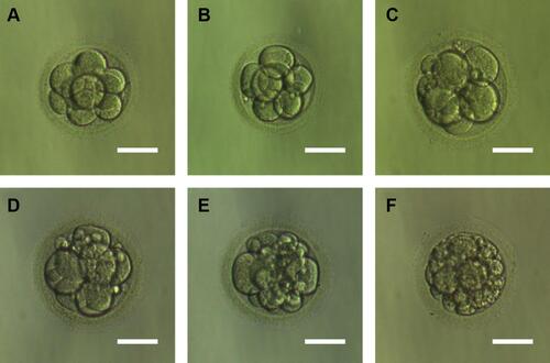 Figure 3 Embryos with different fragments content. (A) Day 3 embryos developing showed fragmentation less than 5%. (B) Day 3 embryos developing showed 5–10% fragmentation. (C) Day 3 embryos developing showed 10–15% fragmentation. (D) Day 3 embryos developing showed 15–20% fragmentation. (E) Day 3 embryos developing showed 20–25% fragmentation. (F) Day 3 embryos developing showed more than 25% fragmentation. Scale bar, 60 μm.