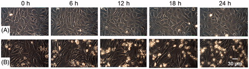 Figure 2. Effect of breast tumor cells conditioned media on morphology and attachment of endothelial cells. (A) Endothelial cells treated with control medium (see video 1, Supplementary material) and (B) Endothelial cells treated with ZR-75-30 cells conditioned medium (see video 2, Supplementary material). Micrographs were obtained at 0, 6, 12, 18 and 24 h of treatment by time lapse microscopy. This assay is representative of the three independent experiments performed.
