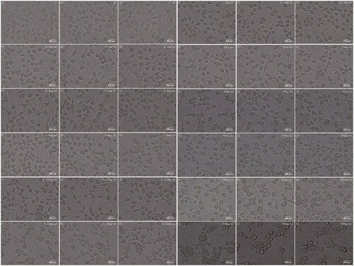 Figure 2. The microscope images for cell morphology. NC symbol the APP cells were not treated by Fuzi. The other images symbol the APP cells were treated by Fuzi solution of different concentration, from 0.4 to 300 mg/ml.
