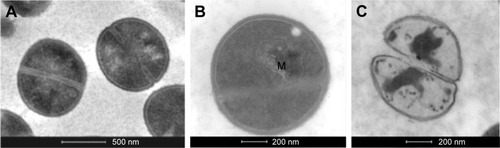 Figure 10 TEM images of untreated (A) and treated (B, C) Staphylococcus aureus cells from the pellet. In panel B, there is a cell that presents a mesosome-like particle (M). In panel C, a lysed cell is represented (scale bars of panel A =500 nm; panels B, C =200 nm).Abbreviation: TEM, transmission electron microscopy.