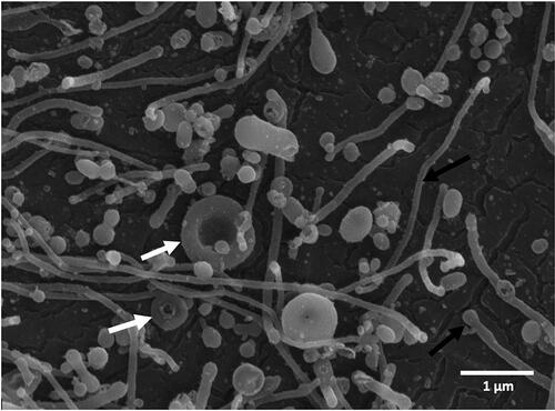 Figure 2 Scanning electron micrograph of a typical isolate of CNVs from the blood plasma sample with characteristic shapes of particles without internal structures including spheres, tubules (black arrows), and tori (white arrows). No residual cells are observed in the figure.