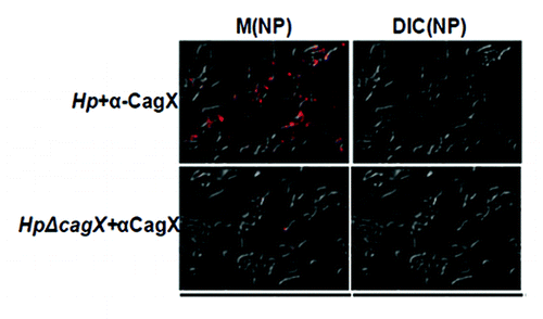 Figure 5. Visualization of CagX into wild type and null mutant of H. pylori. Fluorescence images were recorded which have showed the surface localization of CagX in H. pylori wild type strain.