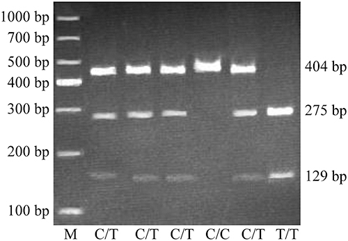 Figure 1 Genotyping of the CD24 gene polymorphism P170 by BstXI RFLP. The 1000 bp ladder was run as a standard. PCR fragments with TT underwent digestion to yield 2 fragments (275 and 129 bp, respectively); those with CT yielded 3 fragments (275, 129 and 404 bp, respectively), while CC-containing fragments were undigested (404 bp).