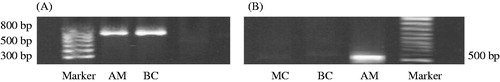Figure 1. Integration of exogenous MCP-1 cDNA into the mesangial cells of rats. (A) The neor sequence of DNA on transfected pLXSN vector in mesangial cells by PCR; (B) the MCP-1 fragment of DNA amplified by PCR in mesangial cells.