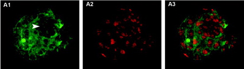 Figure 1.  Blastocyst stained using the trophectoderm (TE) selective labeling method. A1) TE cells labeled with Alexa Fluor 488-conjugated wheat germ agglutinin (WGA). Arrowhead shows inner cell mass (ICM) location, where green fluorescence intensity is lower. A2) TE and ICM nuclei staining with propidium iodide. A3) merged A1 and A2 images.