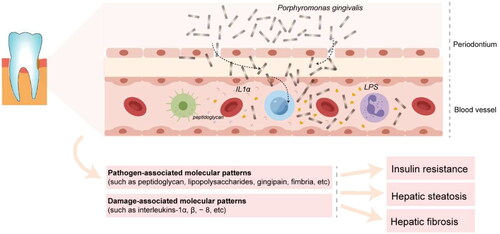 Figure 2. Porphyromonas gingivalis infection induces bacteremia and endotoxemia accelerating the progression of NAFLD.