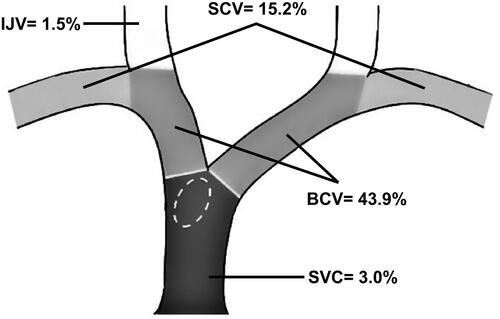 Figure 1 The anatomical distribution of solitary central vein lesions in hemodialysis patients. Combined lesions (not illustrated) contributed to 24 (36.4%) of the patients as follow: 9 (13.6%) cases involved SCV + BCV, 9 (13.6%) cases BCV + SVC, 2 (3.0%) cases SCV+BCV+SVC, 1 (1.5%) case IJV + SVC, 1 (1.5%) case IJV + BCV, 1 (1.5%) case IJV + BCV + SVC, and 1 (1.5%) case SCV + IJV + BCV.