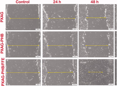 Figure 8. Scratch assay images of 100 μg/mL of PXAG, PXAG-PHB and PXAG-PHB/FFE scaffold treated diabetic wounded cell models using different incubation time intervals (control, 24, 48 and 72 h).