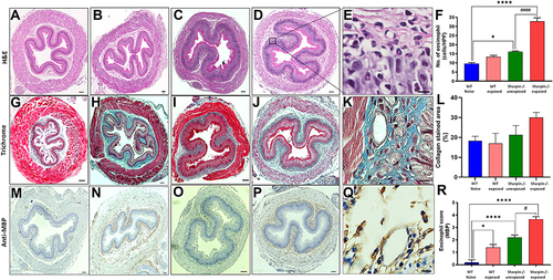 Figure 2 Aspergillus & OVA exposure led to EoE like characteristics in the esophagus. H&E stain of mouse esophagus (4X objective) in a cross-sectional analysis showing different layers in (A) WT naïve, (B) WT exposed, (C) Sharpin-/- unexposed and (D) Sharpin-/- exposed groups, respectively. Morphology of Eosinophil (E) is clearly highlighted in a partially enlarged image (40X objective). (F) represents average number of Eosinophils per HPF counted in five random sites. Trichrome stain of mouse esophagus (4X objective) showing collagen deposition in (G) WT naïve, (H) WT exposed, (I) Sharpin-/- unexposed and (J) Sharpin-/- exposed groups, respectively. An enlarged image (K) showing thick deposition of collagen as indicated by blue color. Blue color was quantified using ImageJ and represented as percent collagen-stained area (L). Immunochemical staining of mouse eosinophils with major basic protein in the esophagus of (M) WT naïve, (N) WT exposed, (O) Sharpin-/- unexposed and (P) Sharpin-/- exposed groups, respectively. A partially enlarged image (Q) showing eosinophils with dark brown color. (R) represents average number of anti-MBP positive cells. Values are means ± SD; n=5–7 mice/group. ****p<0.0001, *p<0.05 vs WT naïve; ####p<0.0001, #p<0.05 vs Sharpin-/- unexposed. Scale- 100µm.