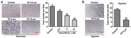 Figure 2. PF inhibits the angiogenesis of HRCECs under both normoxia and hypoxia. (a) HRCECs were treated with PF (0.5, 5, or 15 µM) for 24 h under normoxia, the angiogenesis ability of cells was detected with tube formatting assay. (b) HRCECs were treated with PF (0.5, 5, or 15 µM) for 24 h under hypoxia, the angiogenesis ability of cells was detected. *P < 0.05, **P < 0.01 compared with the control group; n= 3.