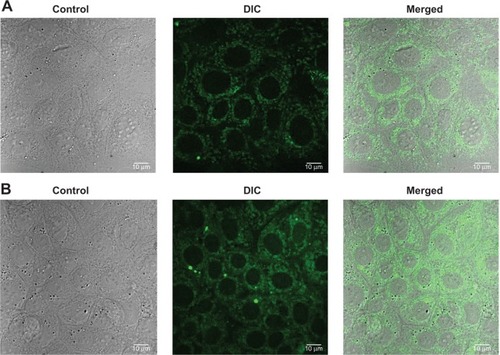 Figure 8 Confocal microscopy and differential interference contrast (DIC) images of MCF-7 cells.Notes: (A) Formulation NP4 at concentration 50 μL for 3 hours; (B) Formulation NP4 at concentration 100 μL for 3 hours.