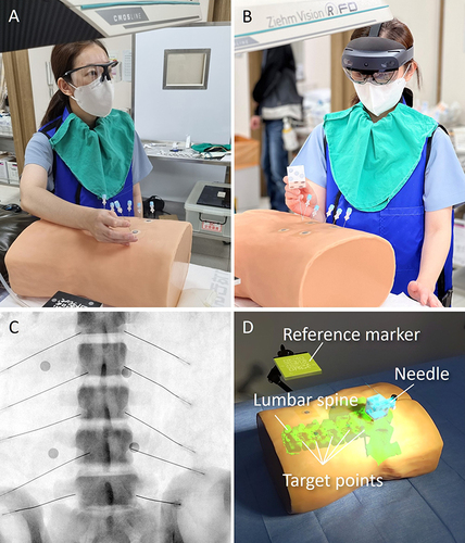Figure 5 Procedure simulation. Epidural needle insertion under the guidance of (A) radiographs and (B) augmented reality-based navigation. (C) The final placement of the needle tip is confirmed by fluoroscopy. (D) In the AR group, the reference marker, the lumbar spine 3D model, target points, and the epidural needle are continuously tracked.