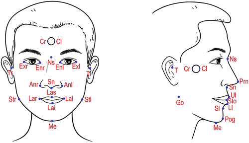 Figure 1 Facial landmarks in frontal and profile views.