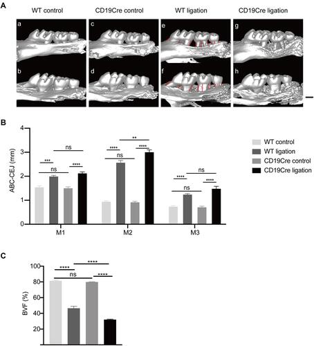 Figure 1 Alveolar bone loss induced by ligation. (A) Representative three-dimensional (3D) views of the maxillae in the different groups. Ligature-induced alveolar bone loss can be seen around the maxillary molars in both ligation groups. (a), (c), (e), and (g) show the buccal side, while (b), (d), (f), and (h) display the palatal side. Scale bar: 500 μm. (B) Comparison of the height of alveolar bone loss. The ABC-CEJ distances (in millimeters) from the alveolar bone crest to cementoenamel junction (ABC-CEJ) was recorded as the sum of the ABC-CEJ distances at 6 sites (mesio-buccal, buccal, disto-buccal, mesio-palatal, palatal, and disto-palata of each molar, indicated by red lines) on the 3D imaging of the three molars. M1: the first maxillary molar. M2: the second maxillary molar. M3: the third maxillary molar. (C) Comparison of the bone volume fraction (BVF) between the WT and CD19Cre group with or without ligature-induced periodontitis. Data are shown as the mean ± standard error of the mean (n = 6 per group). **P < 0.01, ***P < 0.001, ****P < 0.0001, ns no significance (one-way ANOVA).