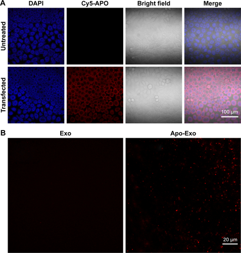 Figure S2 Immunofluorescence analysis for Apo-A1 expression.Notes: (A) Images of immunofluorescence analysis of the Apo-A1 expression in transfected 293T cells. (B) Immunofluorescence analysis for Apo-A1 in Exosome. Exo: exosomes isolated from untransfected 293T cells. Apo-Exo: exosomes isolated from CD63-Apo-A1 vector-transfected 293T cells.Abbreviation: Apo-Exo, Apo-A1-Exosomes.