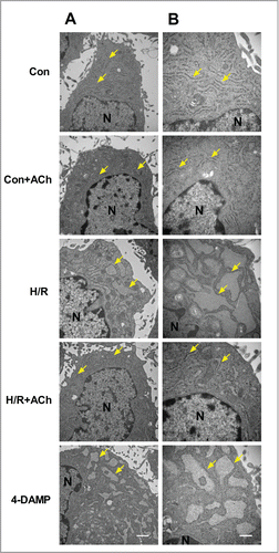 Figure 4. ACh protected against H/R-induced destruction of ER ultrastructure. The transmission electron microscopic observations indicated that ACh could preserve cellular ultrastructural changes triggered by H/R in HUVECs, especially the changes of ER. (A) 20000×, Scale bar = 1 μm. (B) 40000×, Scale bar = 500 nm.