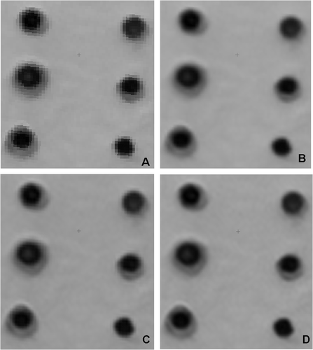 Figure 9. Examples of geometric resampling kernels applied to WorldView-1 panchromatic mode image during the ortho-rectification process with DEM. The sub-images are 193_219 pixels with 0.15-m spacing. Letters A, B, C and D refer to different geometric resampling kernels (nearest neighbour, bilinear, cubic convolution, sin(x)/x with 16_16 window), respectively. WorldView-1 Image_ and courtesy Digital Globe, 2009.