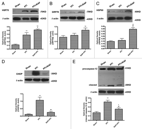 Figure 7. Rapamycin increased HSP70, HSP60, GRP78 expression, while decreasing CHOP and cleaved caspase-12 expression in ischemic cortex. Rats were treated with a single i.c.v. injection of rapamycin 35 pmol 24 h before the onset of PFI. PFI animals received an i.c.v. injection of same volume of vehicle. Rats were killed 24 h after ischemia. The extracts from the ischemic and sham-operated cortex were prepared and separated on SDS-PAGEL and protein levels were detected with immunoblotting. (A) Protein expression of HSP70. (B) Protein expression of GRP78. (C) Protein expression of HSP60. (D) Protein expression of CHOP. (E) Protein expression of caspase-12. Levels of β-actin protein were used as the loading control. Quantitative analysis was performed with Sigma Scan Pro 5. Bar represents mean ± SD, n = 6. *p < 0.05, **p < 0.01 compared with the sham–operated group; #p < 0.05, ##p < 0.01 compared with PFI group.